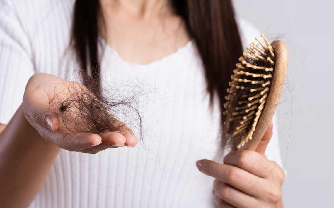 Caída del cabello post chikunguña es frecuente, pero reversible