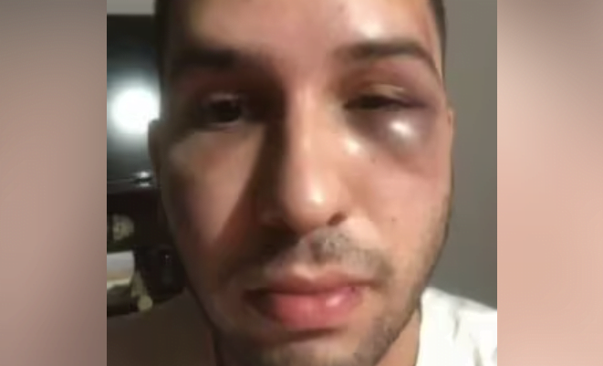 Joven fue brutalmente agredido tras salir de una discoteca en Asunción