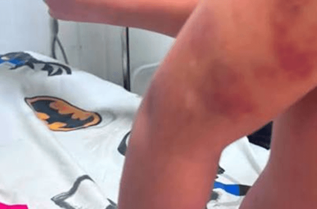 Imputan a la madre y padrastro de niña con TEA que fue brutalmente agredida en PJC Imputan a la madre y padrastro de niña con TEA que fue brutalmente agredida en PJC