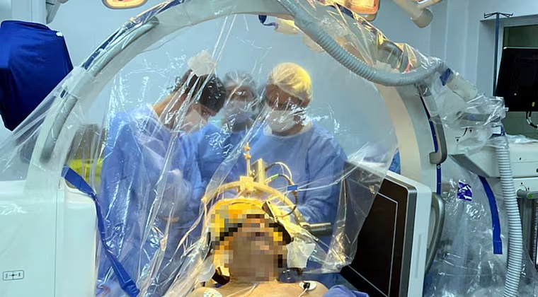 IPS implanta chip cerebral a paciente con Parkinson y marca un hito en neurocirugía IPS implanta chip cerebral a paciente con Parkinson y marca un hito en neurocirugía